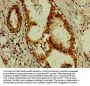 ACTN4 Antibody