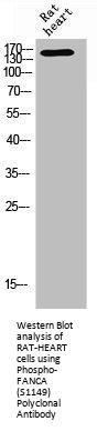Phospho-FANCA (S1149) Antibody