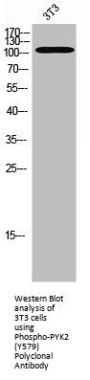 Phospho-PTK2B (Y579) Antibody