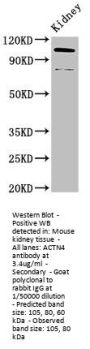 ACTN4 Antibody