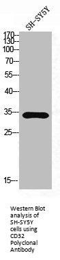 FCGR2B Antibody