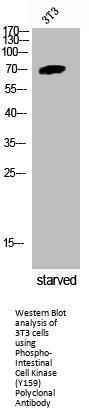 Phospho-ICK (Y159) Antibody