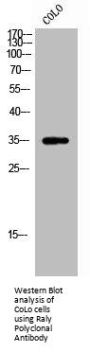 RALY Antibody