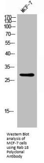 RAB18 Antibody