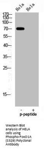 Phospho-FOXO1 (S329) Antibody
