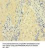 FASLG Antibody