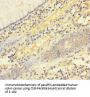 FASLG Antibody