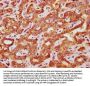 FAU Antibody