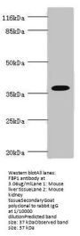FBP1 Antibody