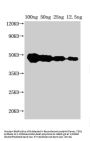 FEN1 Antibody