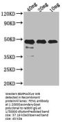 FEN1 Antibody