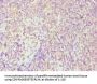 Rabbit anti-human Tyrosine-protein kinase Fes/Fps polyclonal Antibody(FES)