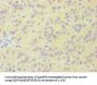 Rabbit anti-human Tyrosine-protein kinase Fes/Fps polyclonal Antibody(FES)