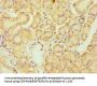 Rabbit anti-human Tyrosine-protein kinase Fes/Fps polyclonal Antibody(FES)