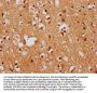 FEZF1 Antibody