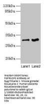 FGFR1OP2 Antibody