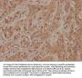 FGFR2 Antibody