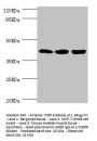 FIBP Antibody