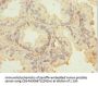 FIBP Antibody