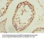 FIBP Antibody