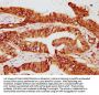 FKBP4 Antibody
