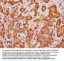 FKBP4 Antibody