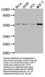 FKTN Antibody