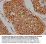 FLCN Antibody