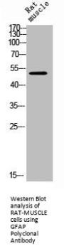 GFAP Antibody