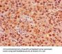 FOXK1 Antibody