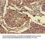 FOXN1 Antibody