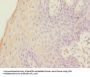 FOXP1 Antibody