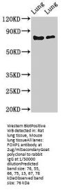 FOXP1 Antibody
