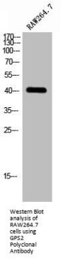 GPS2 Antibody