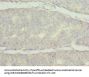 FRK Antibody