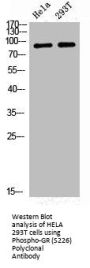 Phospho-GR (S226) Polyclonal Antibody