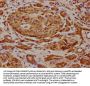 FRYL Antibody
