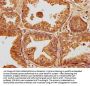 SKOR2 Antibody