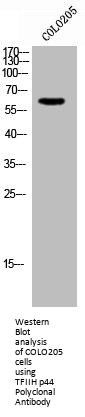 GTF2H2 Antibody