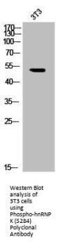 Phospho-HNRNPK (S284) Antibody