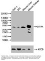 GATM Antibody