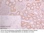 GATM Antibody