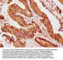 GCLC Antibody