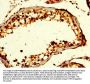 GDF10 Antibody