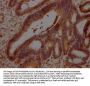 GDF11 Antibody