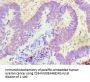 GDF5 Antibody