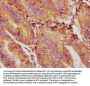 GDF5 Antibody
