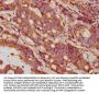 GDF5 Antibody
