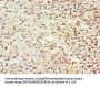 GEM Antibody