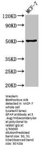 gfap Antibody